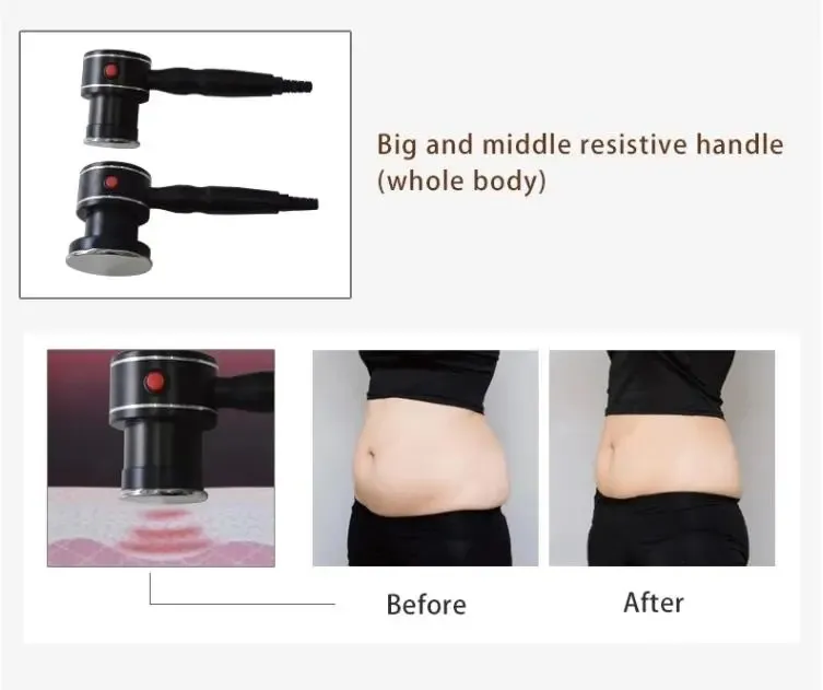 Professional Ret Cet Monopolar Radio Frequency Slimming Apparatus for Body Contouring