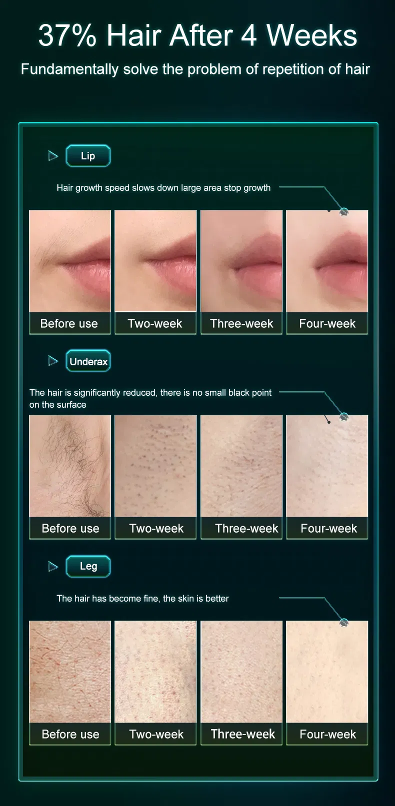 Recharge Virgin Human Body Hair and Armpit Hair Remover