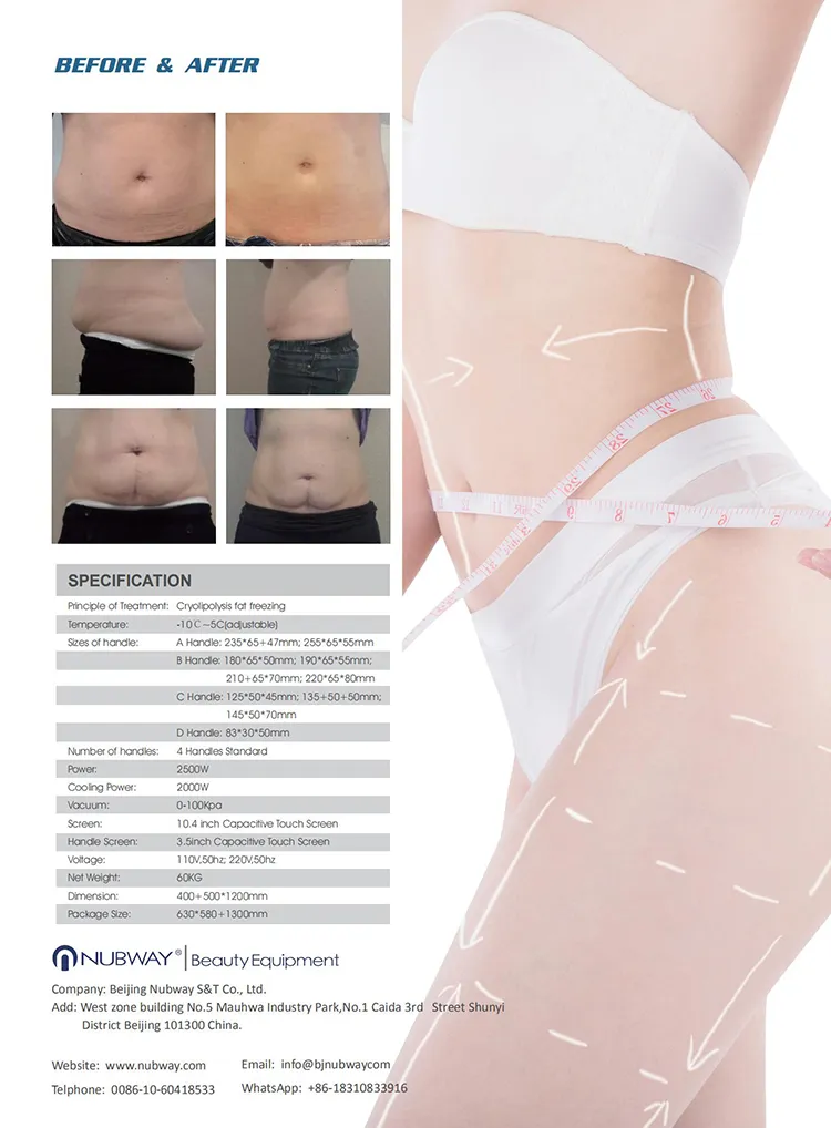 Sale Promotion! ! ! High Quality Freeze Cheap Multi-Functional Cryolipolysis Cold Head RF Cryotherapy Lipolysis Body Magic Reshape Fast Cryo Slimming Machine