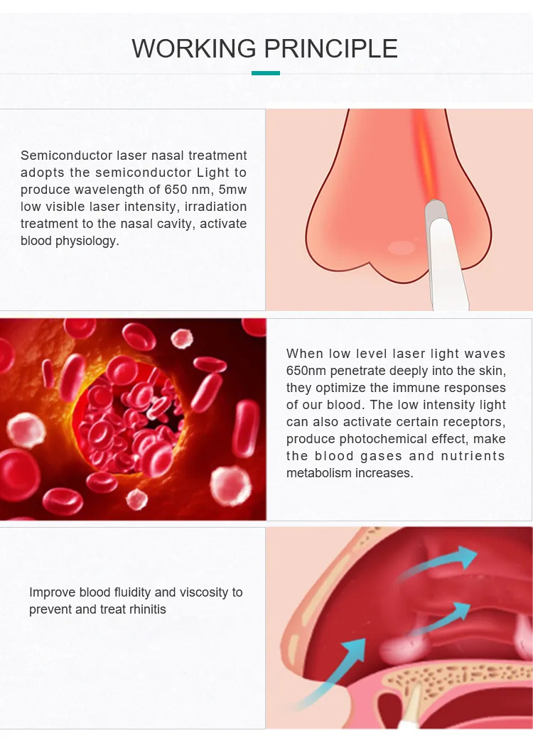 Sinusitis Low Laser Therapy (HY05-A)