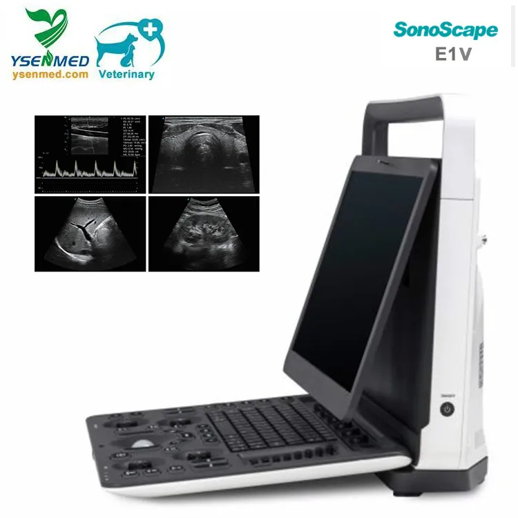 Sonoscape E1V Ultrasound Machines Veterinary Color Doppler Ultrasound