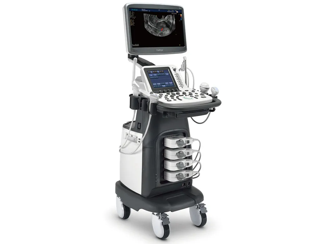 Sonoscape S22 Mobile 3D/4D Color Doppler Ultrasound Scanner