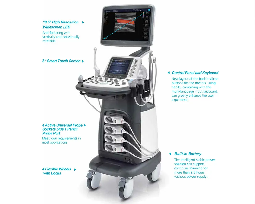 Sonoscape S22 Mobile 3D/4D Color Doppler Ultrasound Scanner