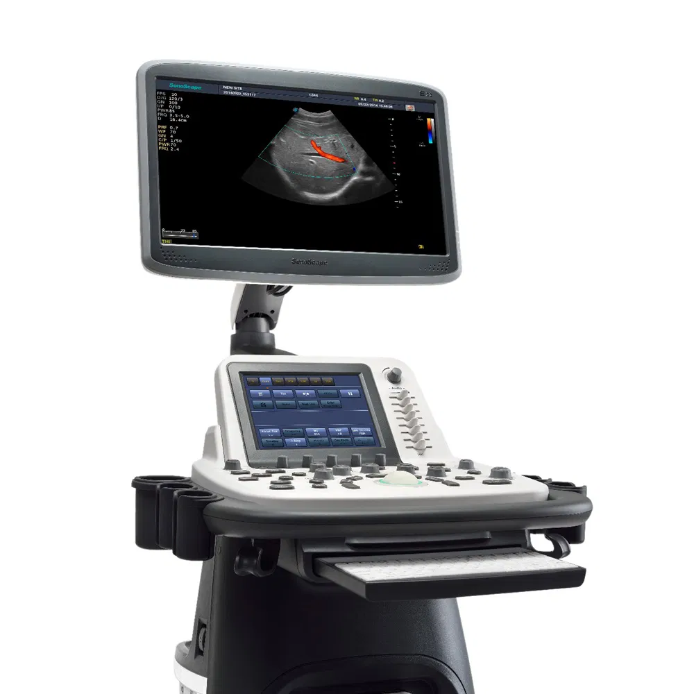 Sonoscape S22 Mobile 3D/4D Color Doppler Ultrasound Scanner