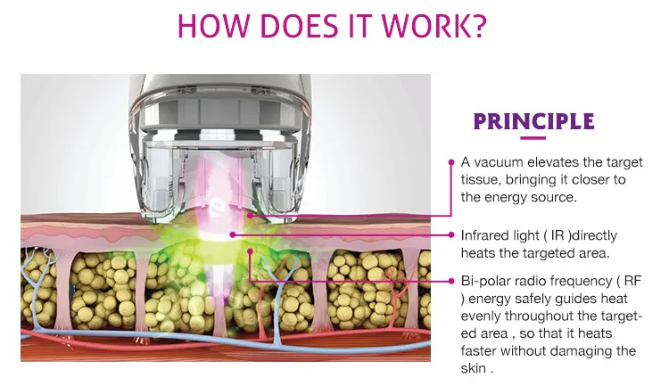 SPA Machine Vacuum Roller Anti-Aging Skin Rejuvenation Wrinkle Removal Cellulite Treatment Machine Lifting Firming