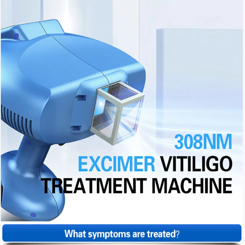 Surgical Skin Care Treatment Device 308nm UVB Combs Excimer Laser 308c/D Lamp Beauty Machine Phototherapy for Skin Care