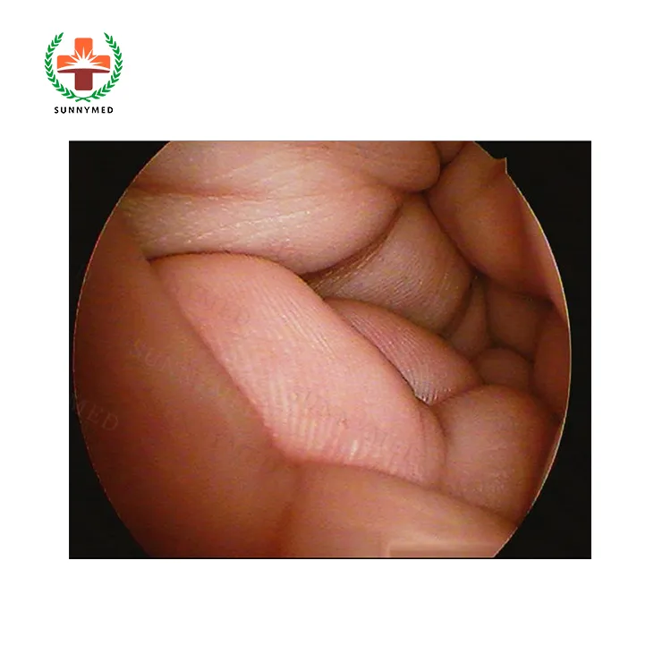 Sy-P031 Medical Endoscopy Camera Imaging Diagnostic Equipment Ent USB Endoscope Camera