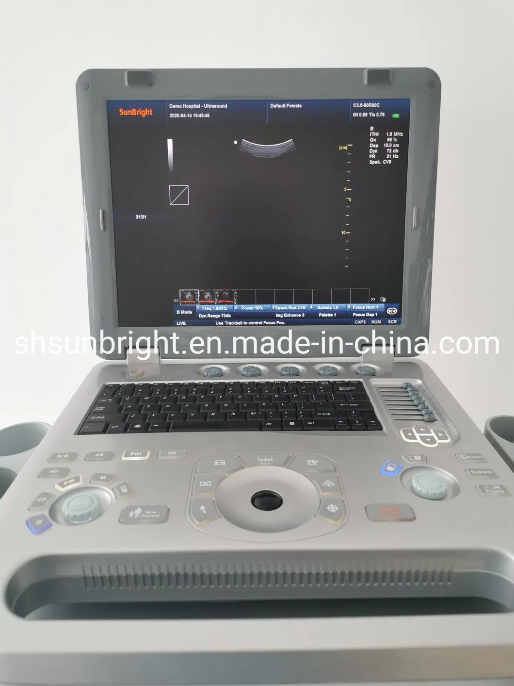 Ultrasound Machine Price Color Doppler Model Sun 906b Good Price and Quality