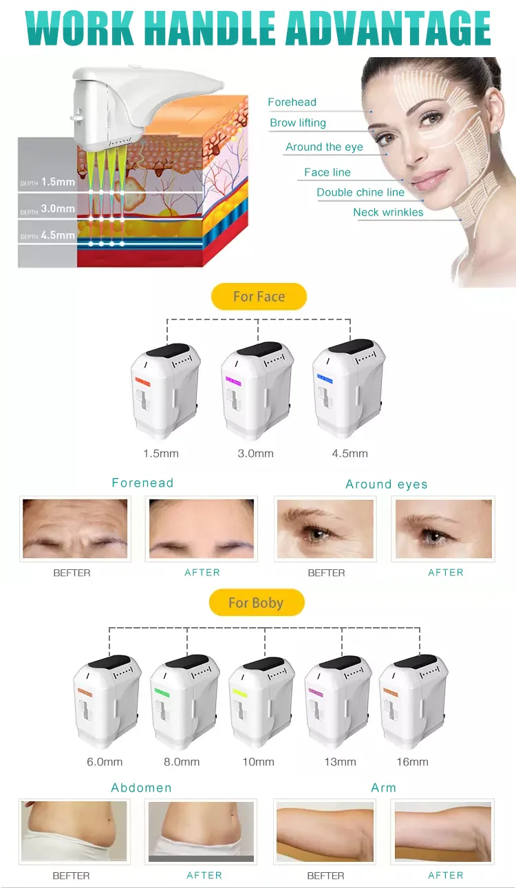 Wholesale Price 9d Hifu+Privacy Machine Skin Lifting Vaginal Rejuvenation Device