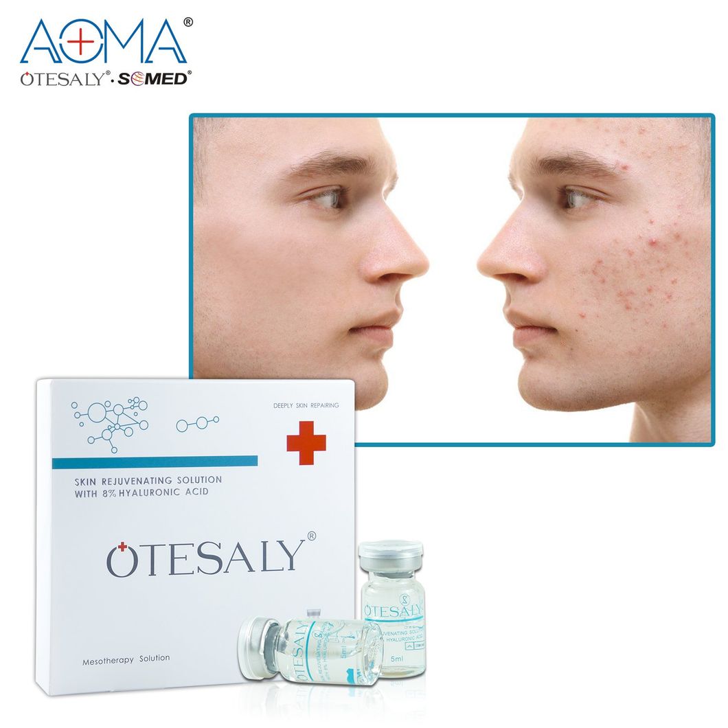 Wholesale Price Otesaly Skin Rejuvenation with 8% Hyaluronic Acid for Face Meso Gun Skin Care Mesotherapy Solution